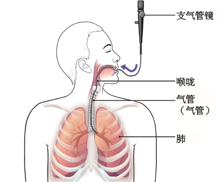 如何使用电子支气管镜：生产厂家提供的入境技巧指南